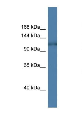 Polyclonal Rabbit anti-Human HK1 / Hexokinase 1 Antibody (aa162-211, WB)
