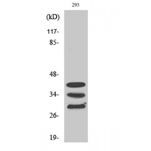 HNRPA1 / HnRNP A1 Antibody (30-110 aa, Internal)