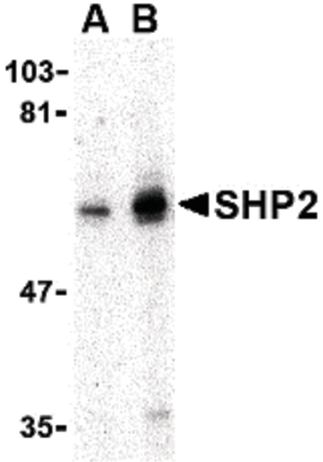 IHC-plus™ PTPN11 / SHP-2 / NS1 Antibody