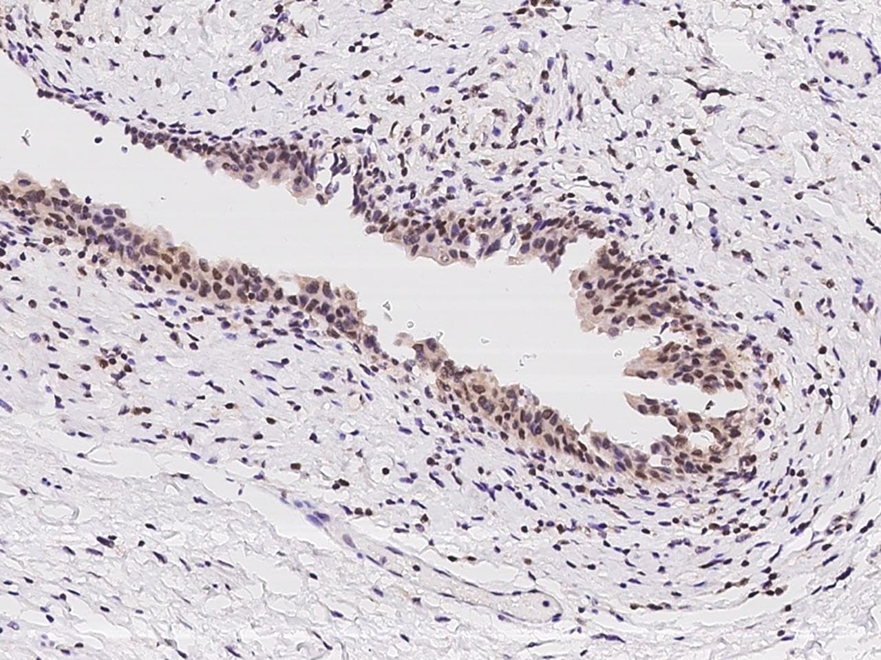 THOC3 Antibody