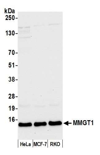 MMGT1 Antibody (aa81-131)