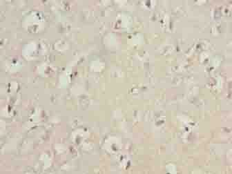 Polyclonal Rabbit anti-Human TUBB1 / Tubulin Beta 1 Antibody (IHC, WB)