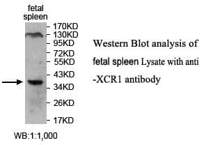 XCR1 Antibody (C-Terminus)