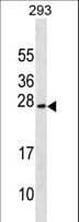 EXOSC1 / CSL4 Antibody (aa165-191)