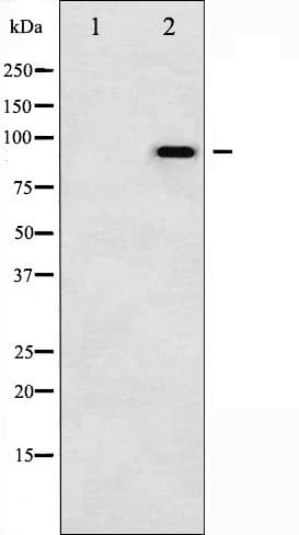 CTNNB1 / Beta Catenin Antibody (phospho-Tyr489)