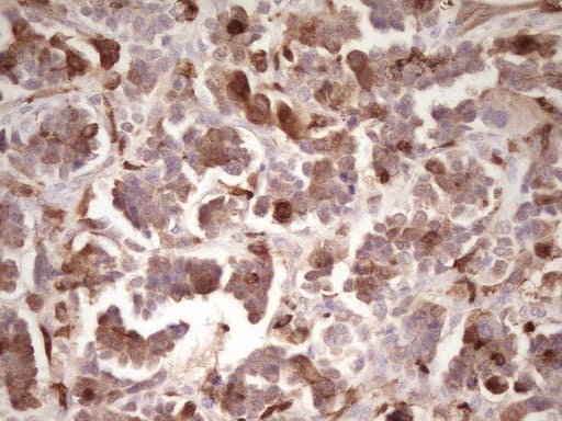 IHC-plus™ LGALS9 / Galectin 9 Antibody (clone 2A4)
