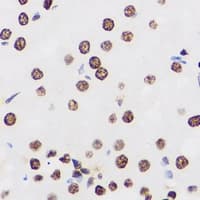 Polyclonal Rabbit anti-Human PRDM14 Antibody (IHC, IF, WB)