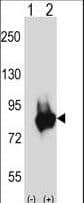 PKD3 / PRKD3 Antibody (aa221-249)