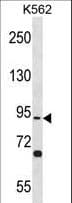 TSGA10 Antibody (aa37-63)
