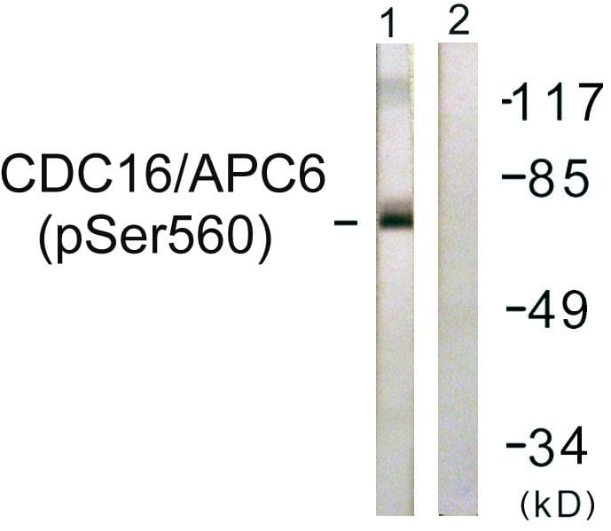 Polyclonal Rabbit anti-Human APC6 / CDC16 Antibody (phospho-Ser560, IHC, IF, WB)
