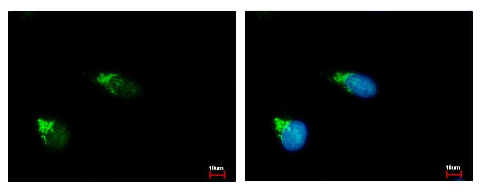 GALNT2 Antibody (aa55-369)