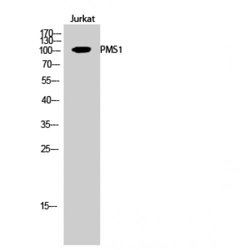 HPMS1 / PMS1 Antibody (410-490 aa, Internal)