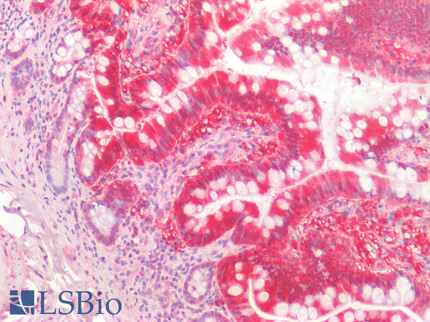 IHC-plus™ TMIGD2 Antibody (clone 8A1)