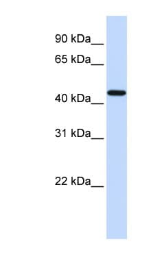 Polyclonal Rabbit anti-Human F2R / Thrombin Receptor / PAR1 Antibody (aa51-100, WB)