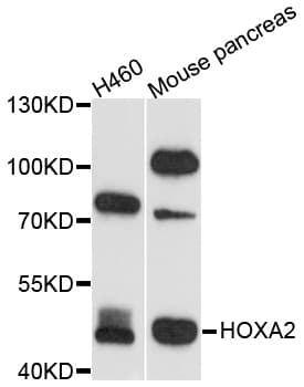 HOXA2 Antibody