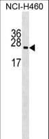 Polyclonal Rabbit anti-Human RPL10A Antibody (aa3-31, WB)