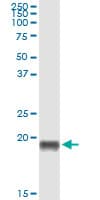 Monoclonal Mouse anti-Human PTN / Pleiotrophin Antibody (clone 1E7, WB)