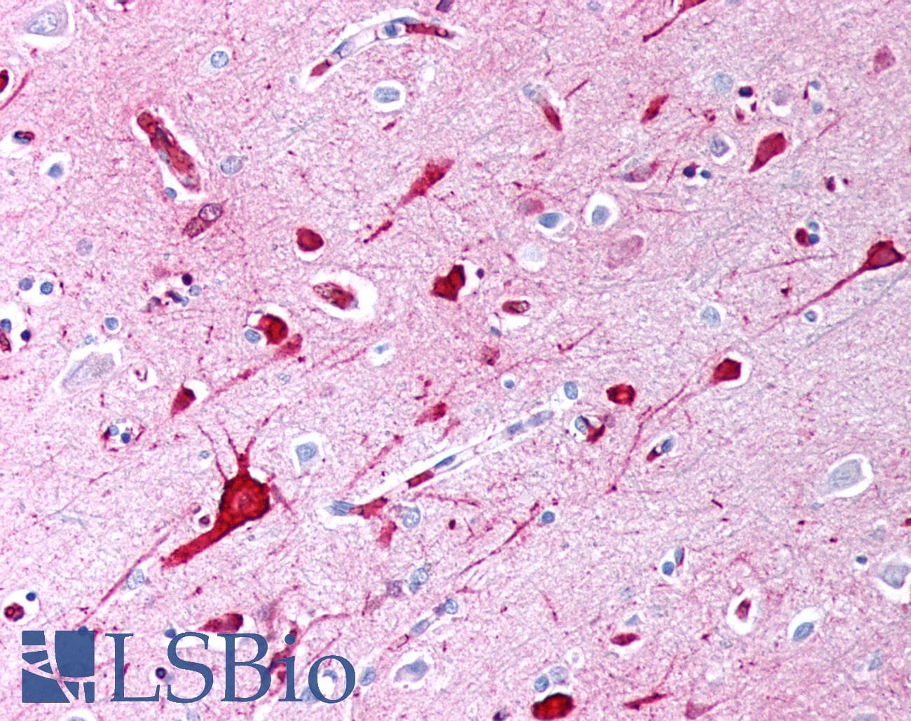 IHC-plus™ Monoclonal Mouse anti-Human TGF-Beta Antibody (clone TB21, IHC)