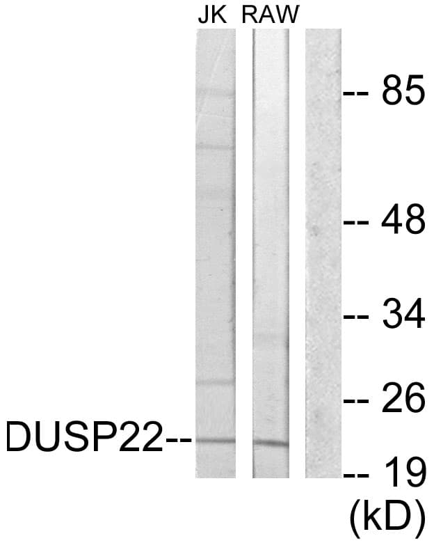 Polyclonal Rabbit anti-Human DUSP22 / JSP 1 Antibody (aa121-170, WB)