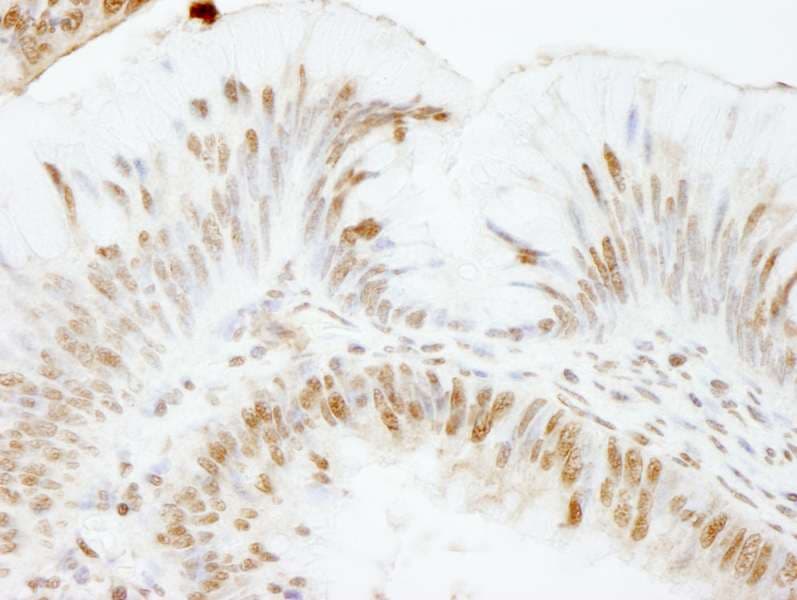 Polyclonal Rabbit anti-Human USP47 Antibody (aa1237-C-term, IHC)