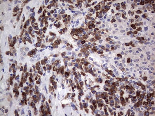 PDGFRA / PDGFR Alpha Antibody (aa32-324, clone 2E9)
