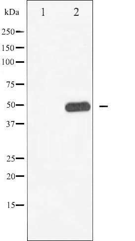 CAMK2A / CaMKII Alpha Antibody (phospho-Thr286)