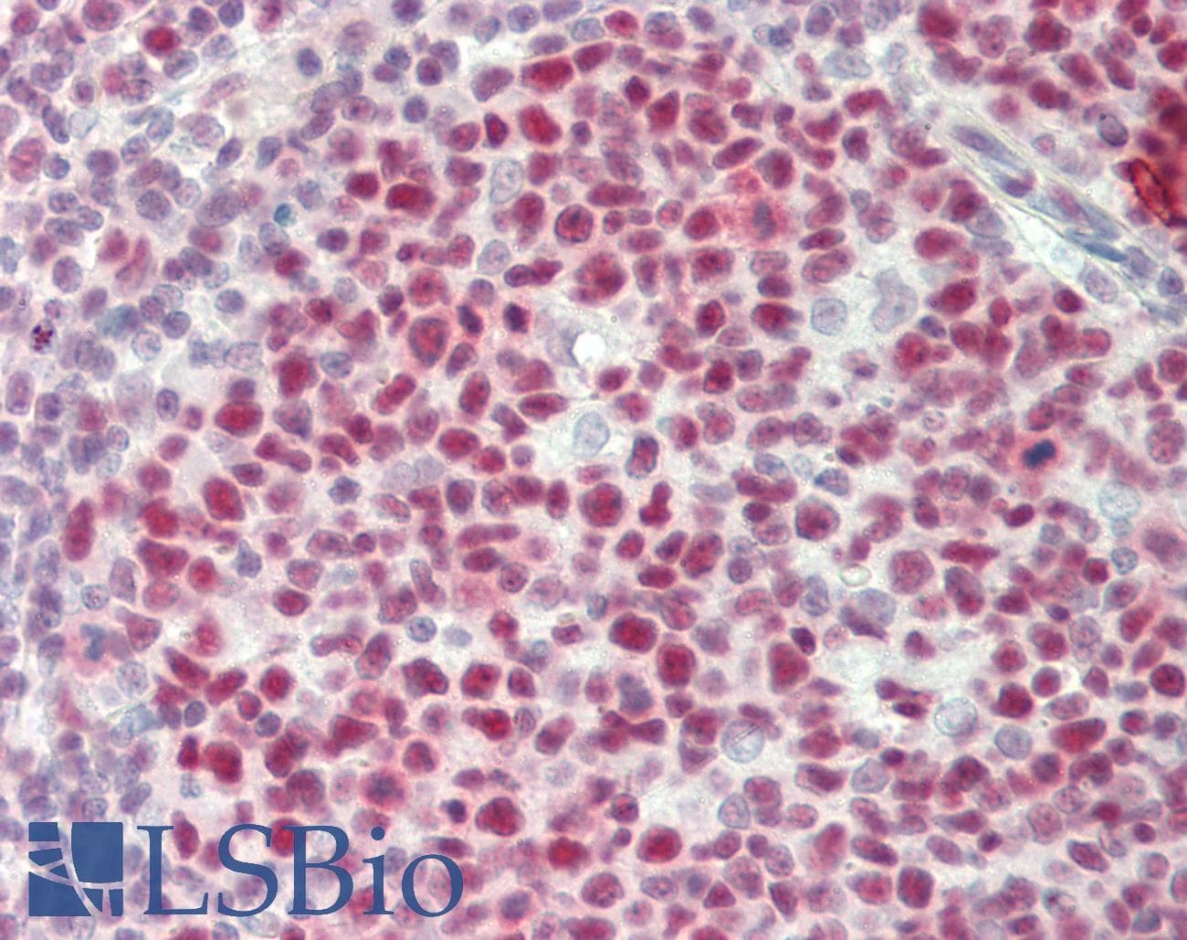 PathPlus™ SMARCA4 / BRG1 Antibody (aa75-125)