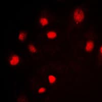 Polyclonal Rabbit anti-Human MCM2 Antibody (N-Terminus, IHC, IF, WB)