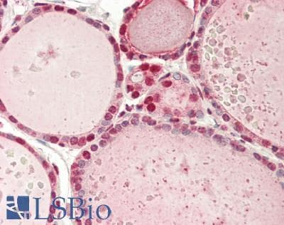 Polyclonal Rabbit anti-Human IDO2 / INDOL1 Antibody (C-Terminus, IHC, WB)