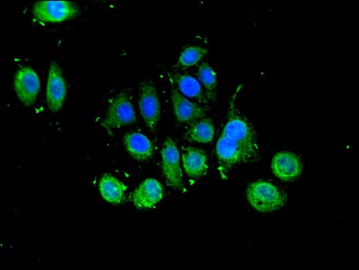 SLU7 / 9G8 Antibody
