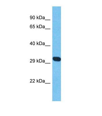 Polyclonal Rabbit anti-Human AK8 Antibody (aa382-431, WB)