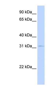 NKX3-1 Antibody (C-Terminus)