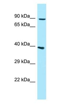 Polyclonal Rabbit anti-Human GPLD1 / GPIPLD Antibody (aa78-127, WB)