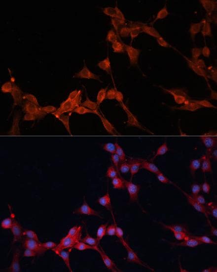 SLC25A38 Antibody
