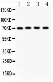 NRG1 / Heregulin / Neuregulin Antibody (aa2-241)