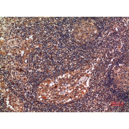 IHC-plus™ ALDH2 Antibody (41-90 aa, N-terminal)
