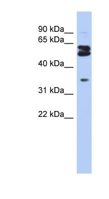 OGFOD1 Antibody (aa467-516)