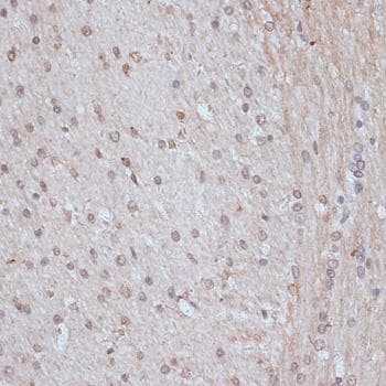 SNW1 / SKIP Antibody