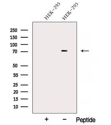 Polyclonal Rabbit anti-Human AKAP8L Antibody (WB)