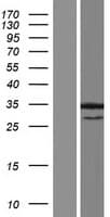 ANKRD7 Protein (Over-Expression Lysate Myc-DDK (Flag))