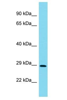 N4BP2L1 Antibody (aa61-110)