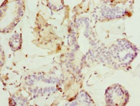 DR1 / NC2 Antibody