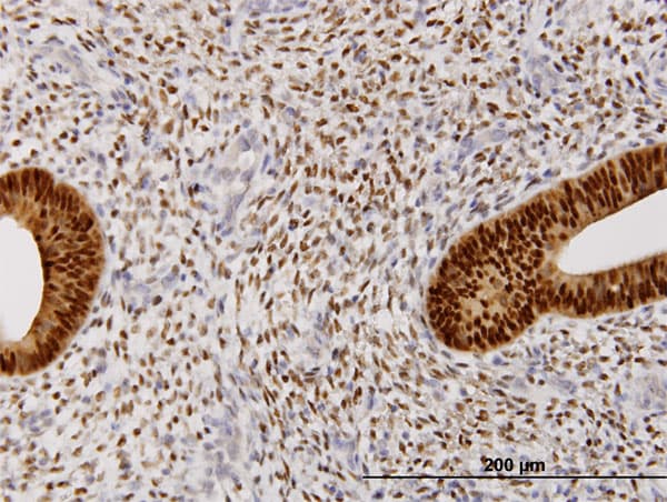 PR / Progesterone Receptor Antibody (clone 1B11)