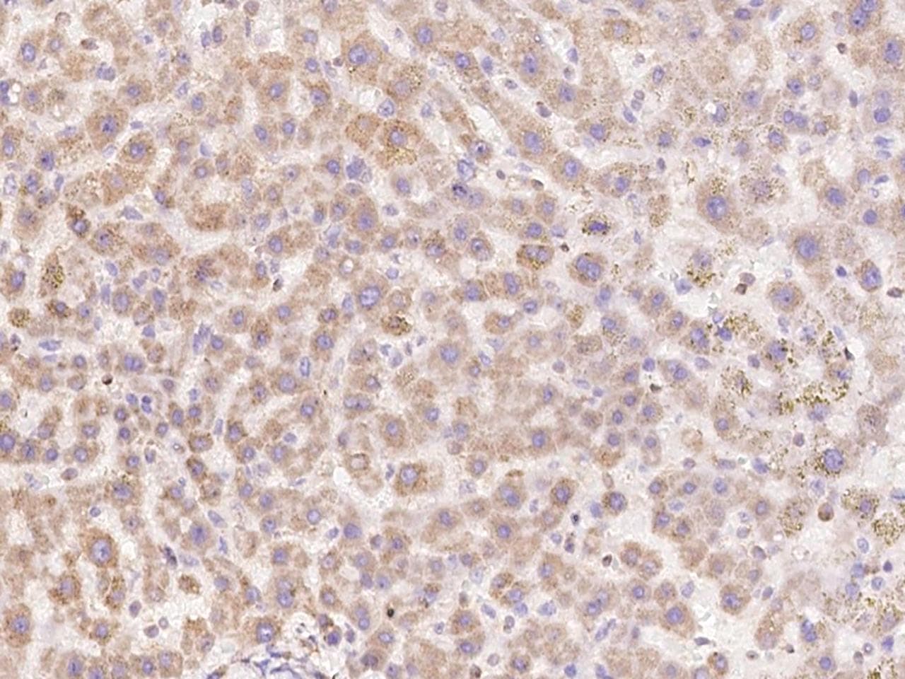 Protein S Antibody (Preservative Free)