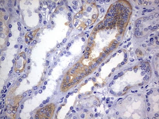 Monoclonal Mouse anti-Human KRT24 / Keratin 24 Antibody (clone OTI4E8, aa139-397, IHC, WB)