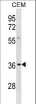 EFNB1 / Ephrin B1 Antibody (aa88-116)