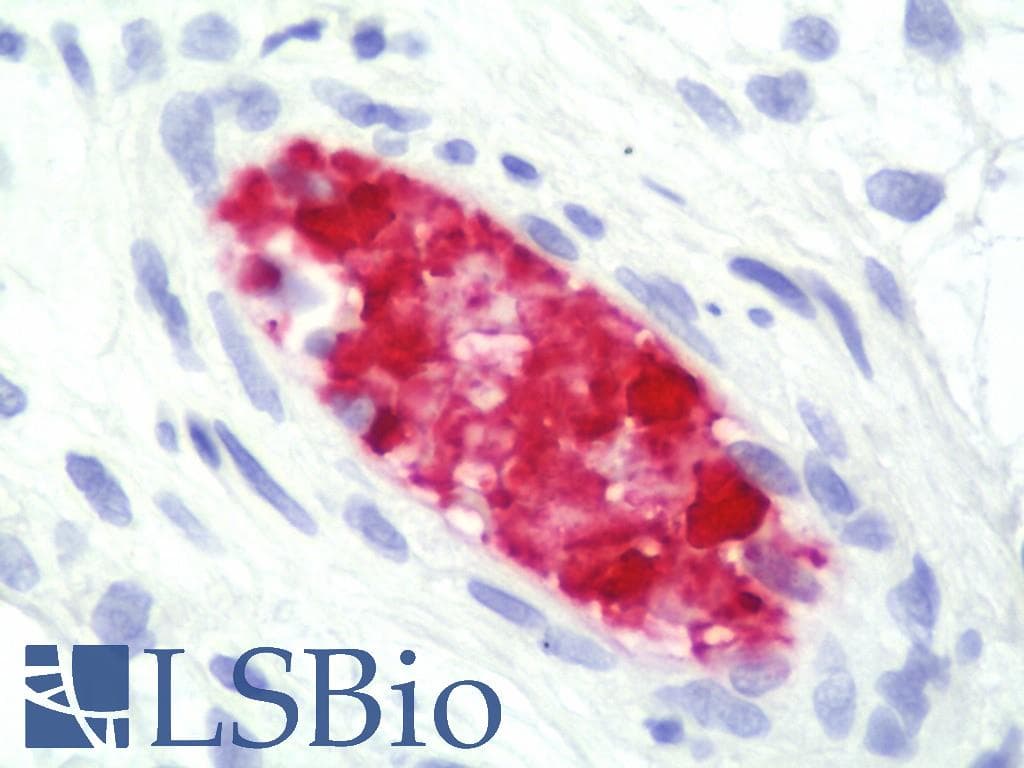IHC-plus™ Hemoglobin Antibody (clone M1709Hg2)