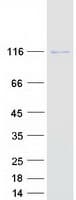 Human VARS2 / ValRS Protein (Recombinant Myc-DDK (Flag))
