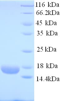 Human ROPN1B Protein (Recombinant His)
