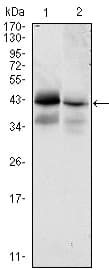 Monoclonal Mouse anti-Human EPCAM Antibody (clone 7E+11, IHC, WB)